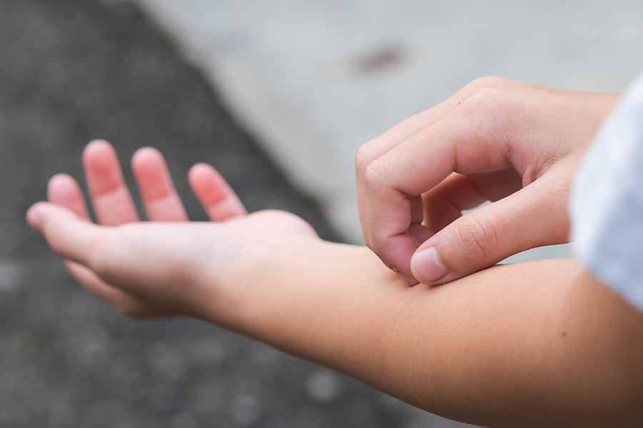 Itching skin from oxycodone abuse